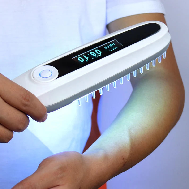 311NM UVB Narrow Band UV Light Source Therapy Lamp Phototherapy Instrument